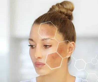 dark_spots_beautystorygr