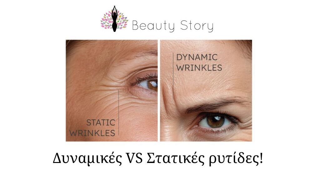 MESOBOTOX Φυσική αντιγήρανση για μέτωπο και μάτια (Παρουσίαση (43)) (5)