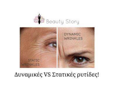 MESOBOTOX Φυσική αντιγήρανση για μέτωπο και μάτια (Παρουσίαση (43)) (5)